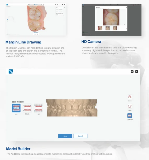 Best Intraoral Dental Scanner
