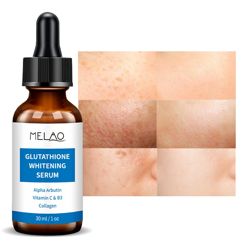 glutathione elixir 6skins 6-in-1 Beauty Elixir with Glutathione