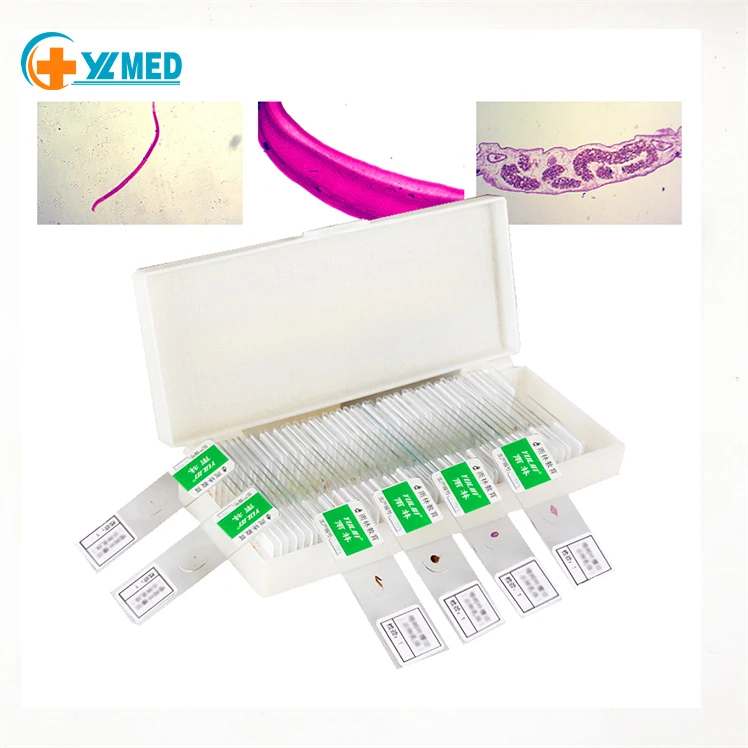 Фабричный Yulin, отдельные острое лимфобластическая лейкемия, приготовленные слайды