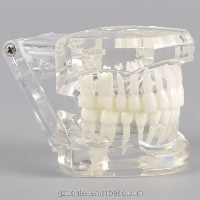 Orthodontic Dental Model Typodont with Transparent Jaw Without Braces Orthodontic Teeth Study Model No Braces Blue