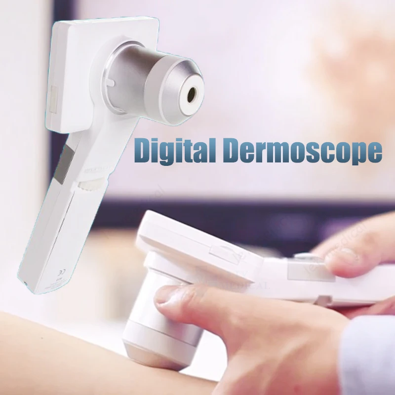 digital dermoscope.jpg
