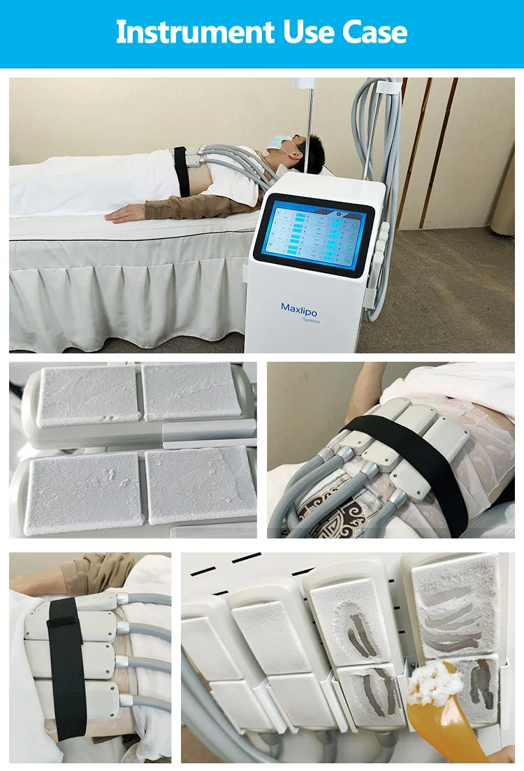 New style 8 cold plates ems microcurrent cryotherapy 2 in 1 function cryo fat freezing machine for fat reduction