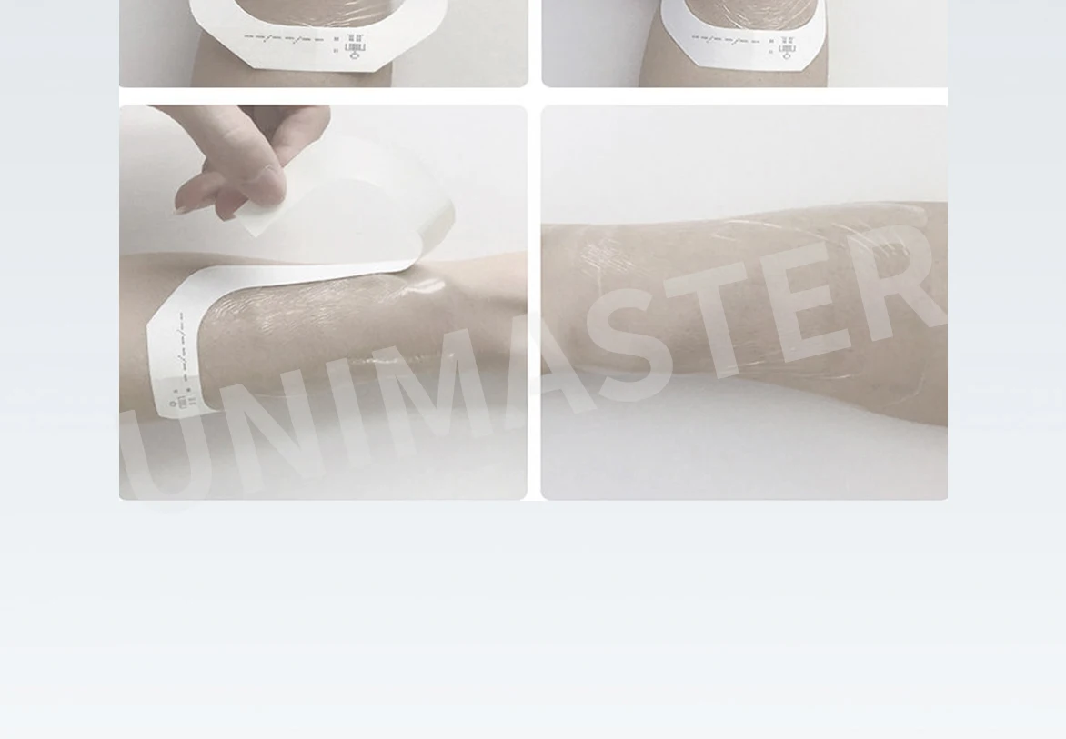 Wound Medical PU Film for White Transparent Waterproof IV Wound Dressing wholesale medical supplies from direct manufacture