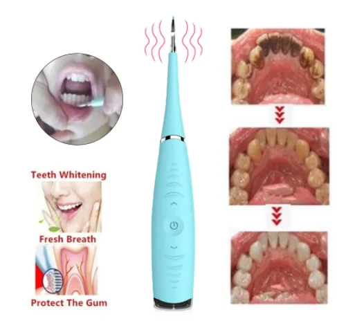 USB зарядка Вибрация Sonic Dental Scaler зубной скалер для удаления зубных пятен клетчатый очиститель инструмент отбеливание зубов Прямая поставка
