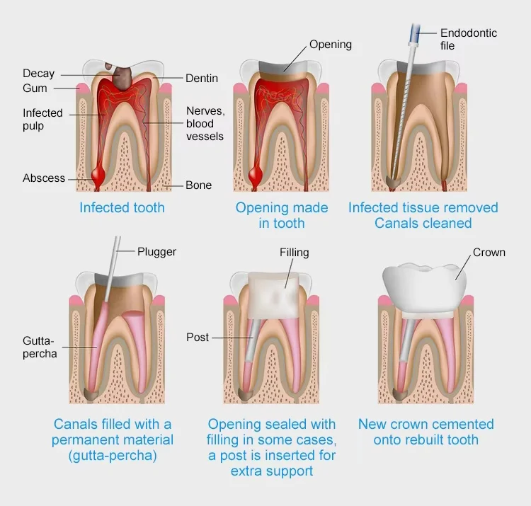 H77b531714b99437192a49ac5d57ab8c54