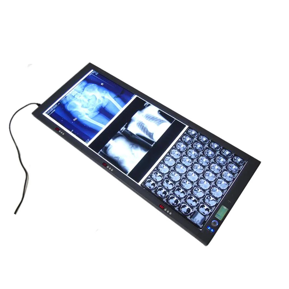 slim x-ray dental triple led x ray film viewer, China slim x-ray dental ...