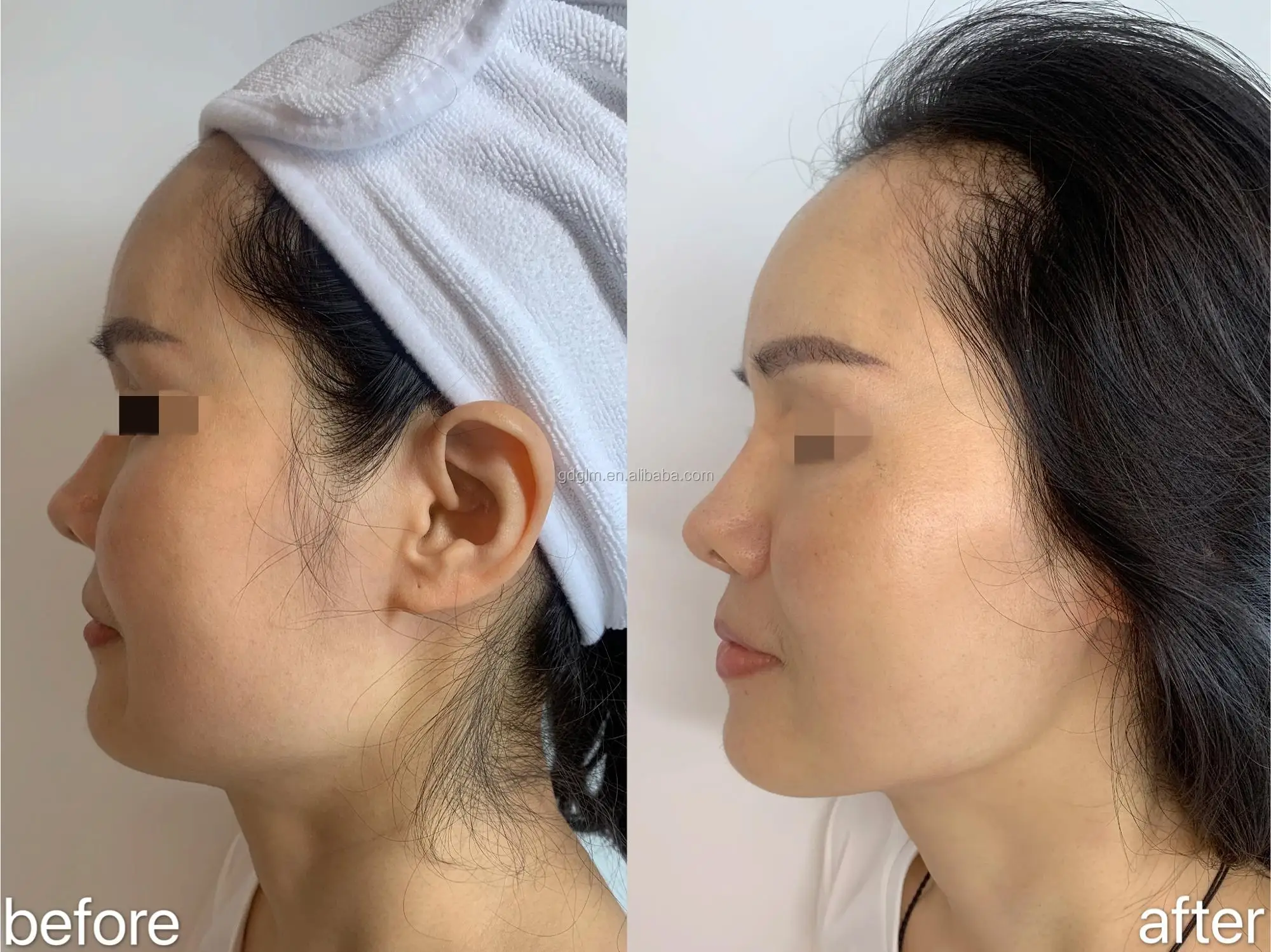 before and after 1