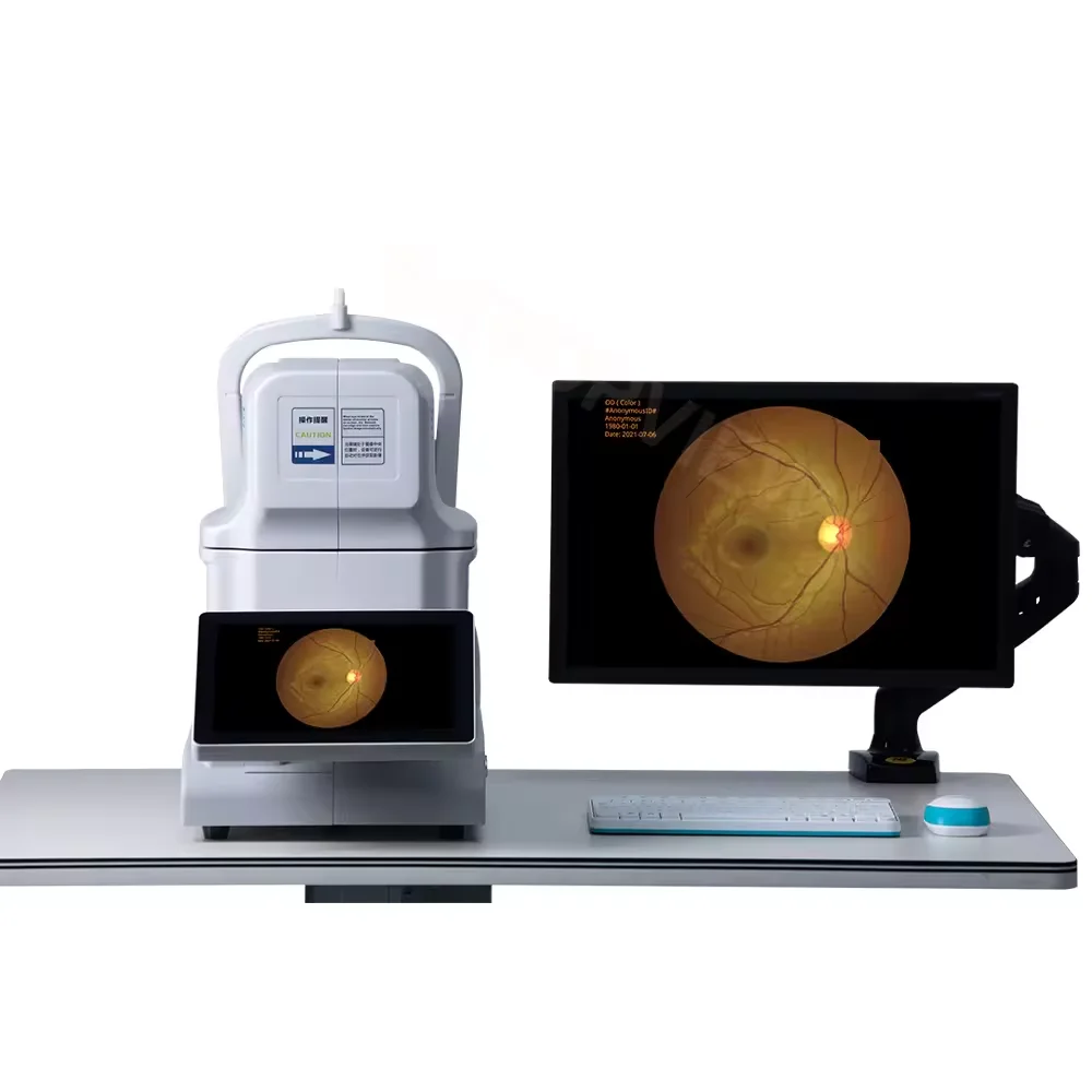 Low Price Cheap Automatic Non-Mydriatic Fundus Camera Auto Fundus Camera Kestrel 3100m For Ophthalmic YDC11