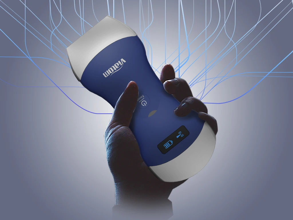 Viatom Probe Wireless Digital Ultrasound Scanner Portable Ultrasound Machine