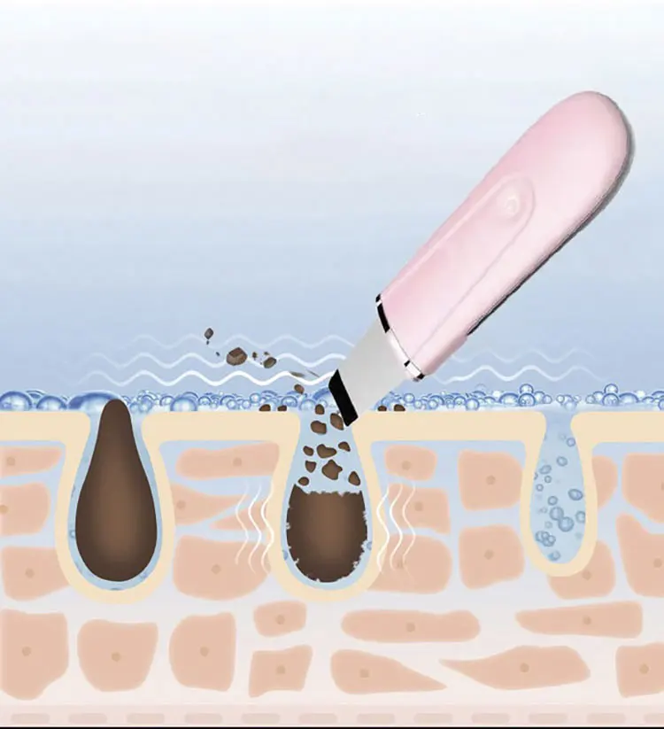 sonic micro vibration blackhead removal wireless charge face cleaning spatula facial ultrasonic skin scrubber machine
