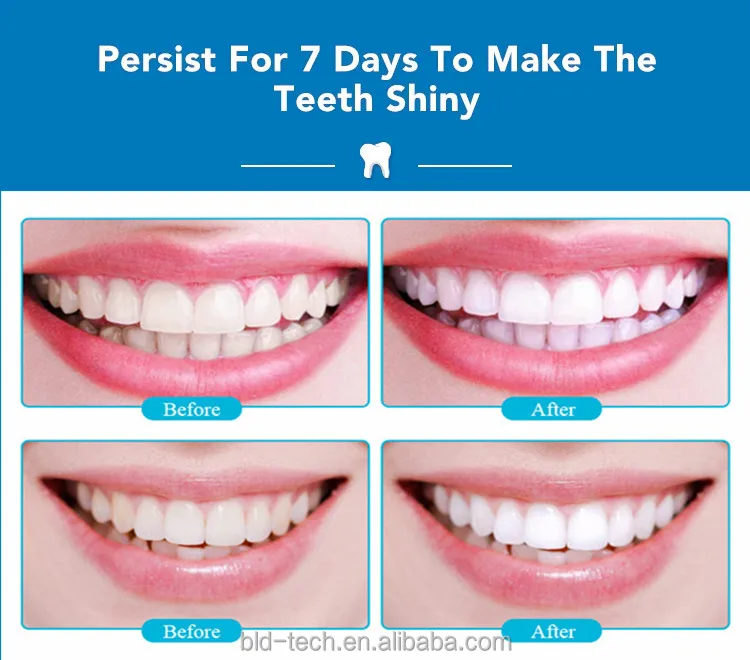 Хит продаж, набор для отбеливания зубов White smile, светодиодный комплект с логотипом
