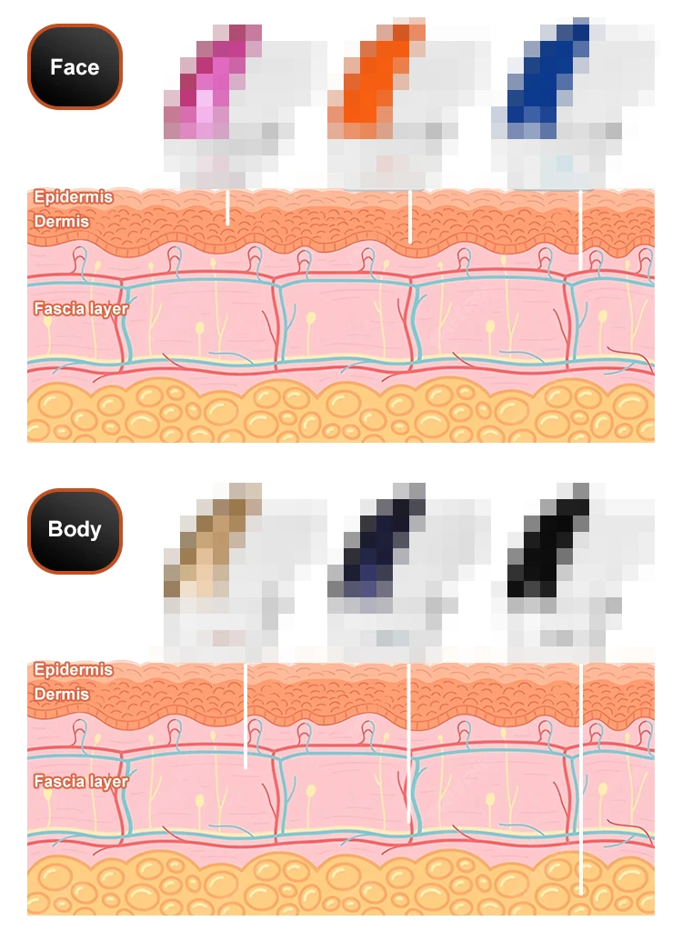 Máquina de belleza portátil Hi Fu 12D para rostro y cuerpo, ultrasonido focalizado de alta intensidad, máquina de ultrasonido 12D, máquina de lifting Smas