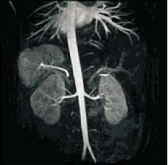 Hospital Medical Magnetic Resonance Imaging System 1.5T  MRI Machine with A-combi and Al Technologies supplier