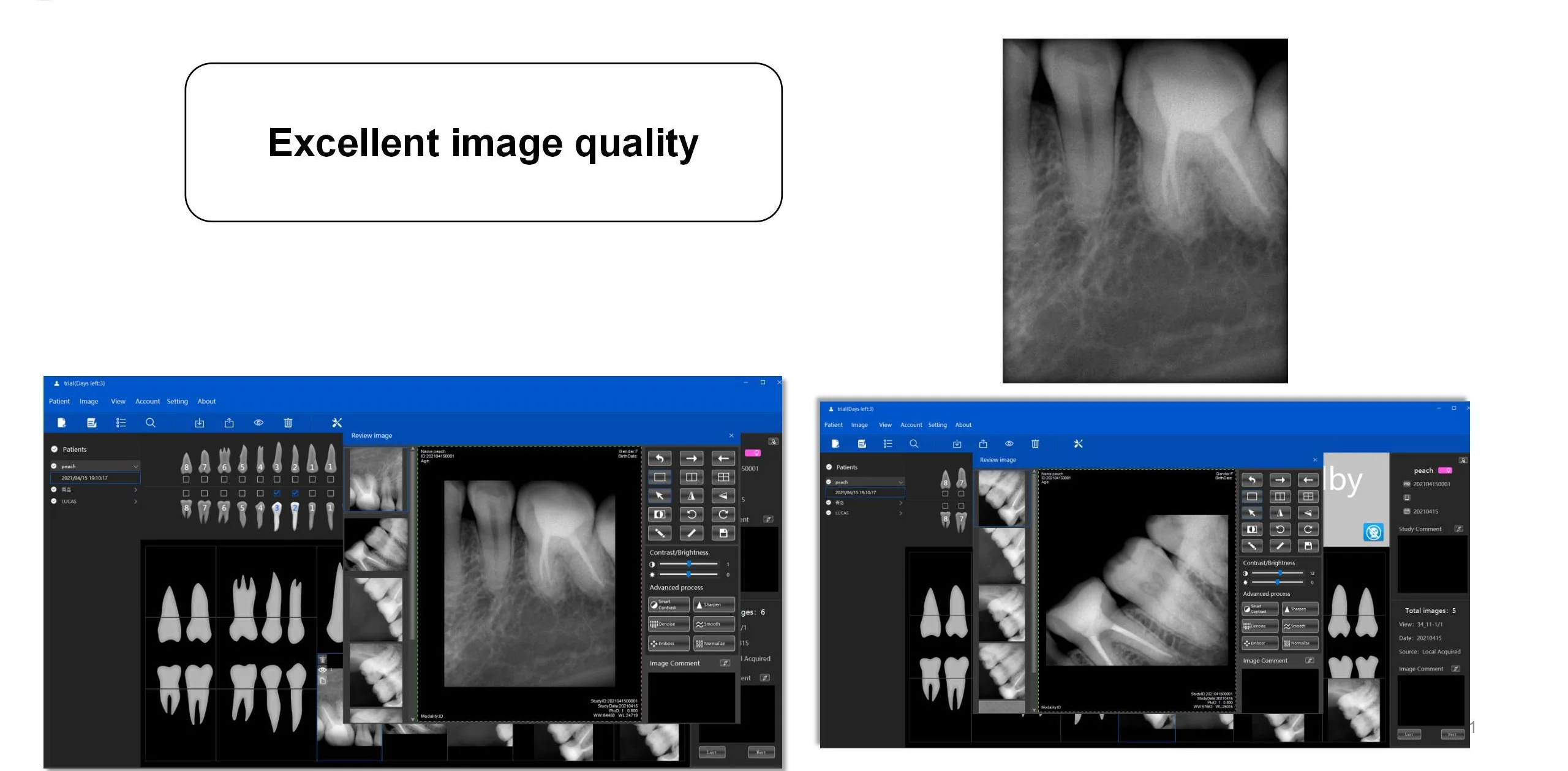 Hotselling Refine Posicionador Rx Size 26*30 Xpect Vision Woodpecker I ...