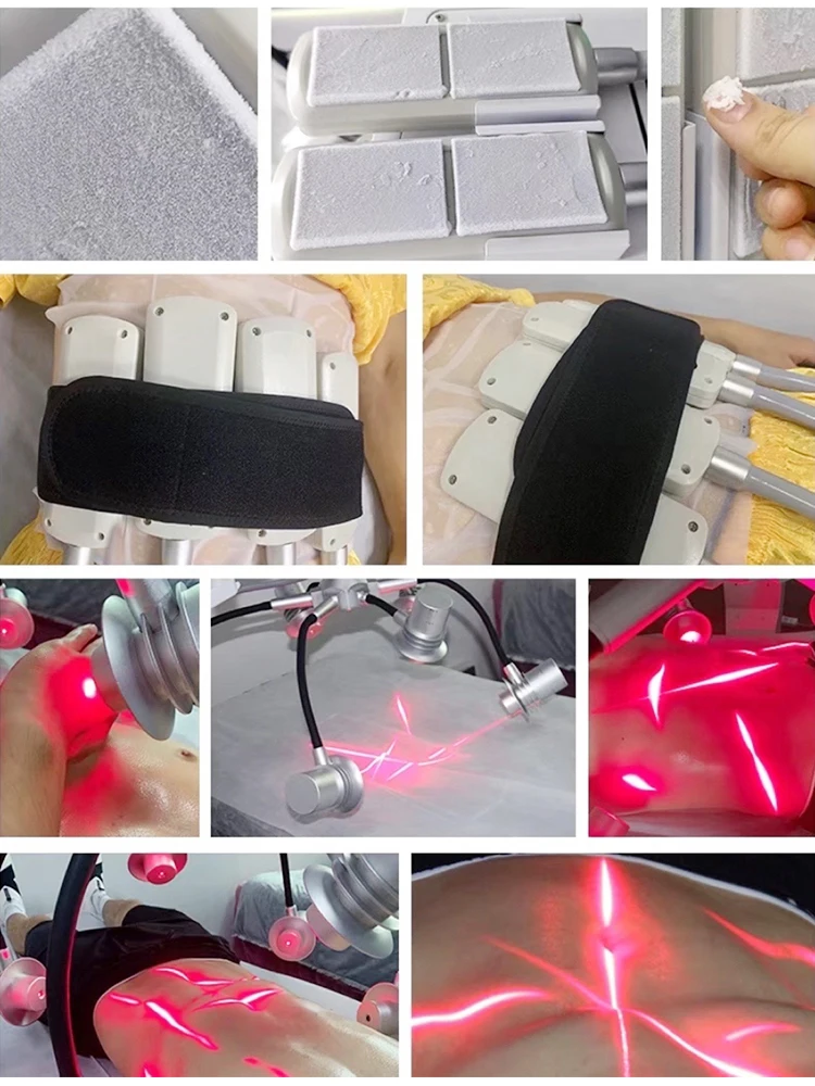 6d laser slimming (8)