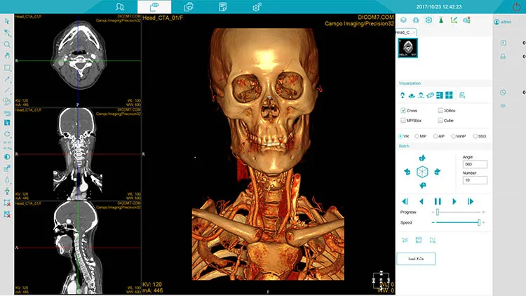 MSLCTX12 Medsinglong Computer Tomography 32-slice Spectral Imaging 2D 3D CT Scanner CT Machine for sale