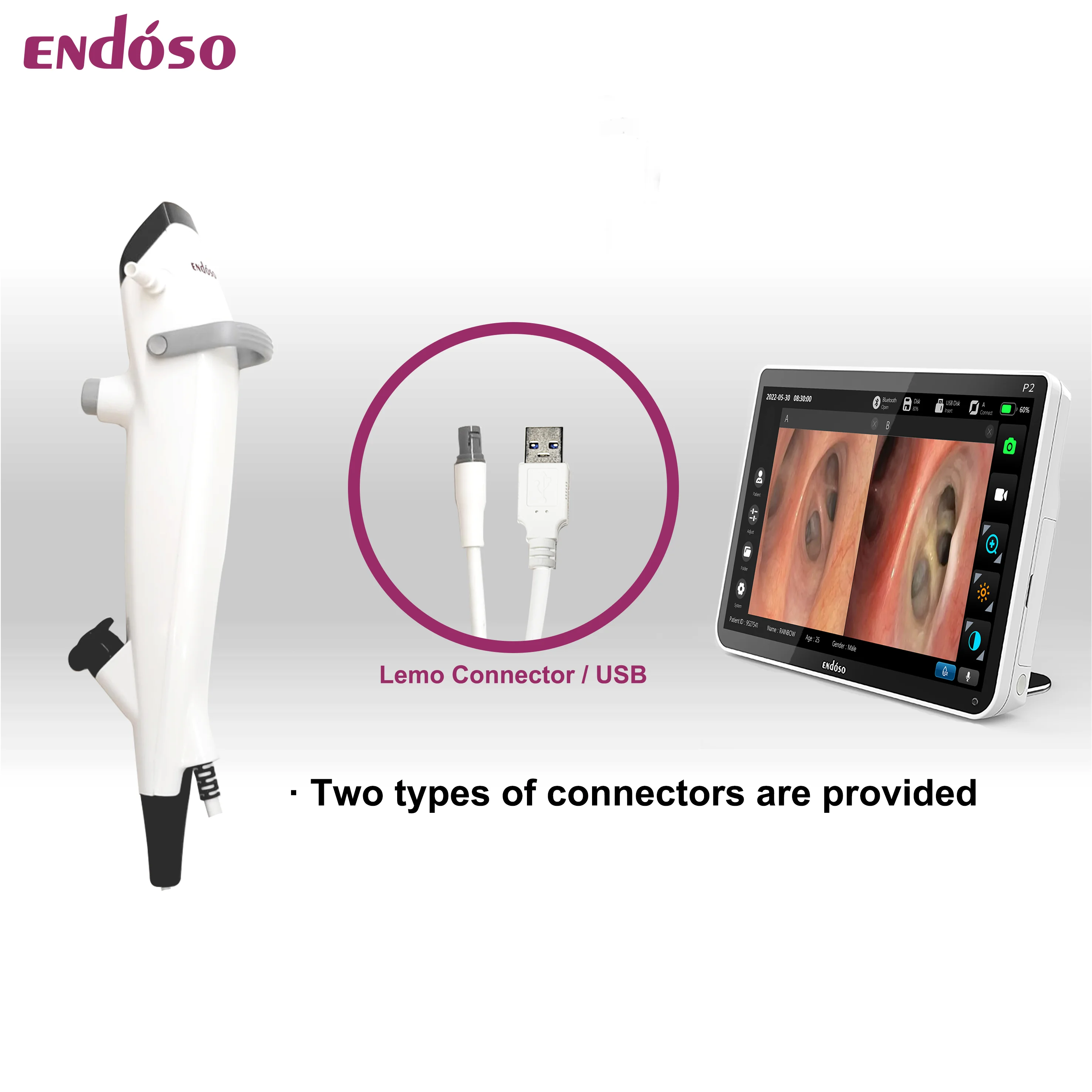 Bronchoscope 2.2 2.4 2.8mm Working Channel Video Broncho Scope Flexible Fiberoptic Bronchoscope Factory Price
