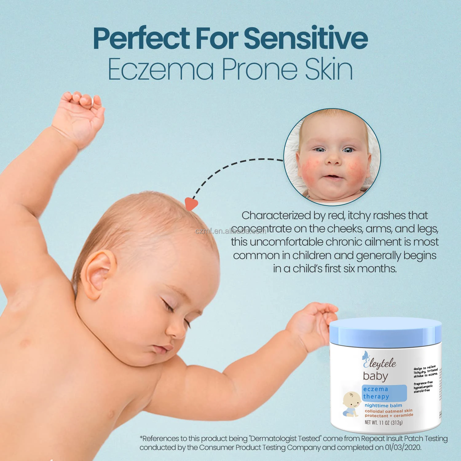 OEM Фирменная торговая марка заводская цена Натуральный Детский бальзам успокаивающий экзема подгузник сыпь отбеливающая Крем от экземы