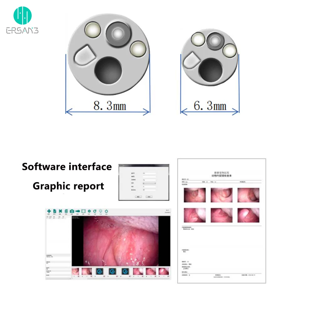 Medical Video Endoscope Endoscopy Machine Gastroscope Colonoscope ...