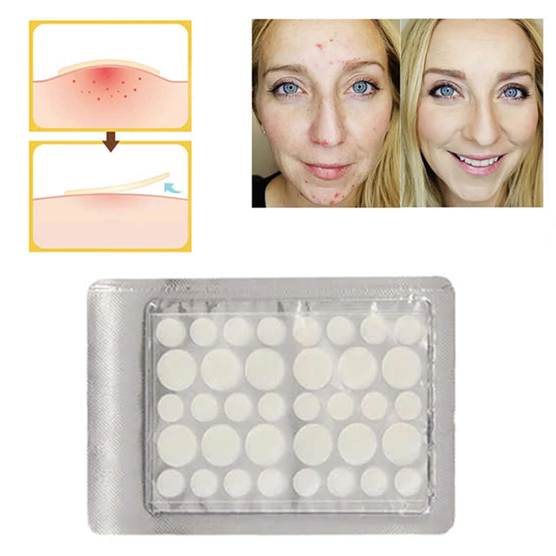 Invisible Acne Patch Skin Care Acne 40 Pcs 36 Dots Pimple Patch For ...