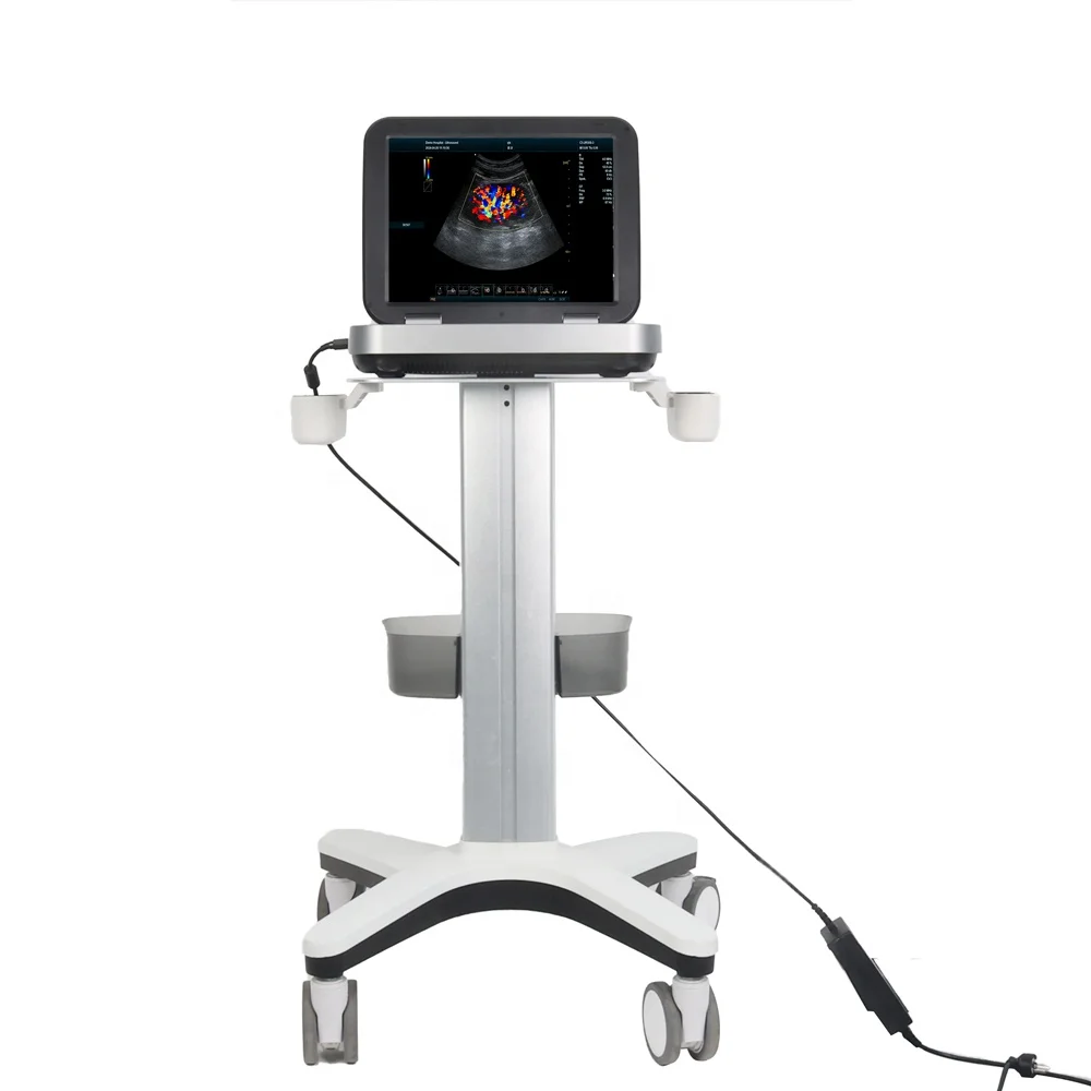 High Quality All-In-One VESA Hospital Trolley Optimal Height-Adjustable Mobile Medical Workstation for Dental Hotels Modern 2