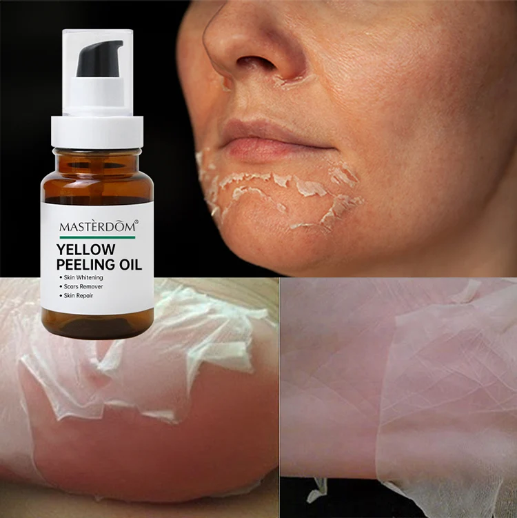 Oem African Extra Strong Bleaching Oil,Dard Skin Dark Knees Knuckles