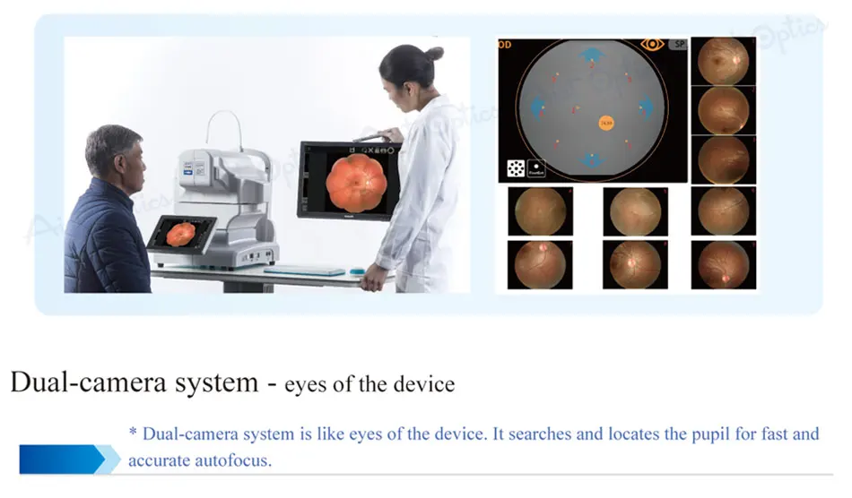 Reticam-3100 Ophthalmic Non-mydriatic Automatic Digital Retinal Fundus Camera