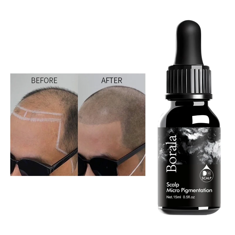 Scalp Micropigmentation Ink Factory Price of SMP Tattoo Pigments Micro Pigmentation Hair Permanent Makeup Pigment