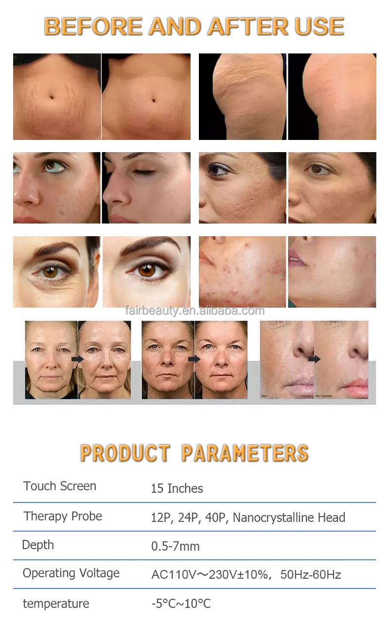 Full Treatment Kit Accessories