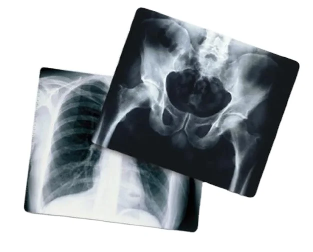 Фотография на рентгеновскую пленку