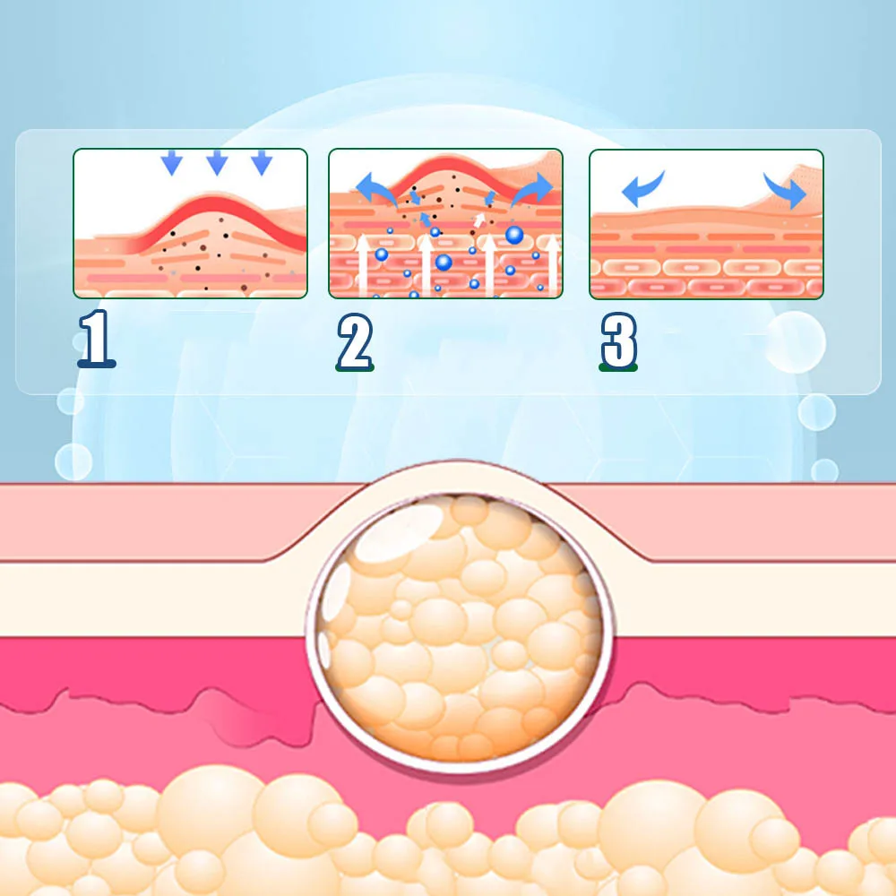 Хит продаж, натуральные травяные Пластыри для удаления комков Липомы, пластыри против набухания лимфатической детоксикации