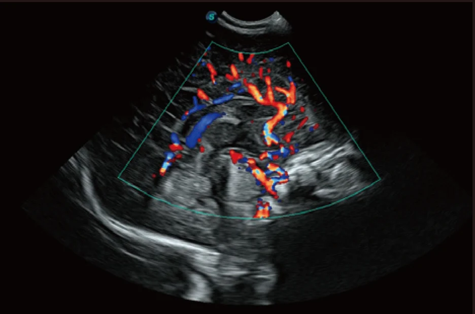 Sonoscape P20 Mobile 3D/4D Real-time Color Panoramic Doppler Trolley Ultrasound Machine factory