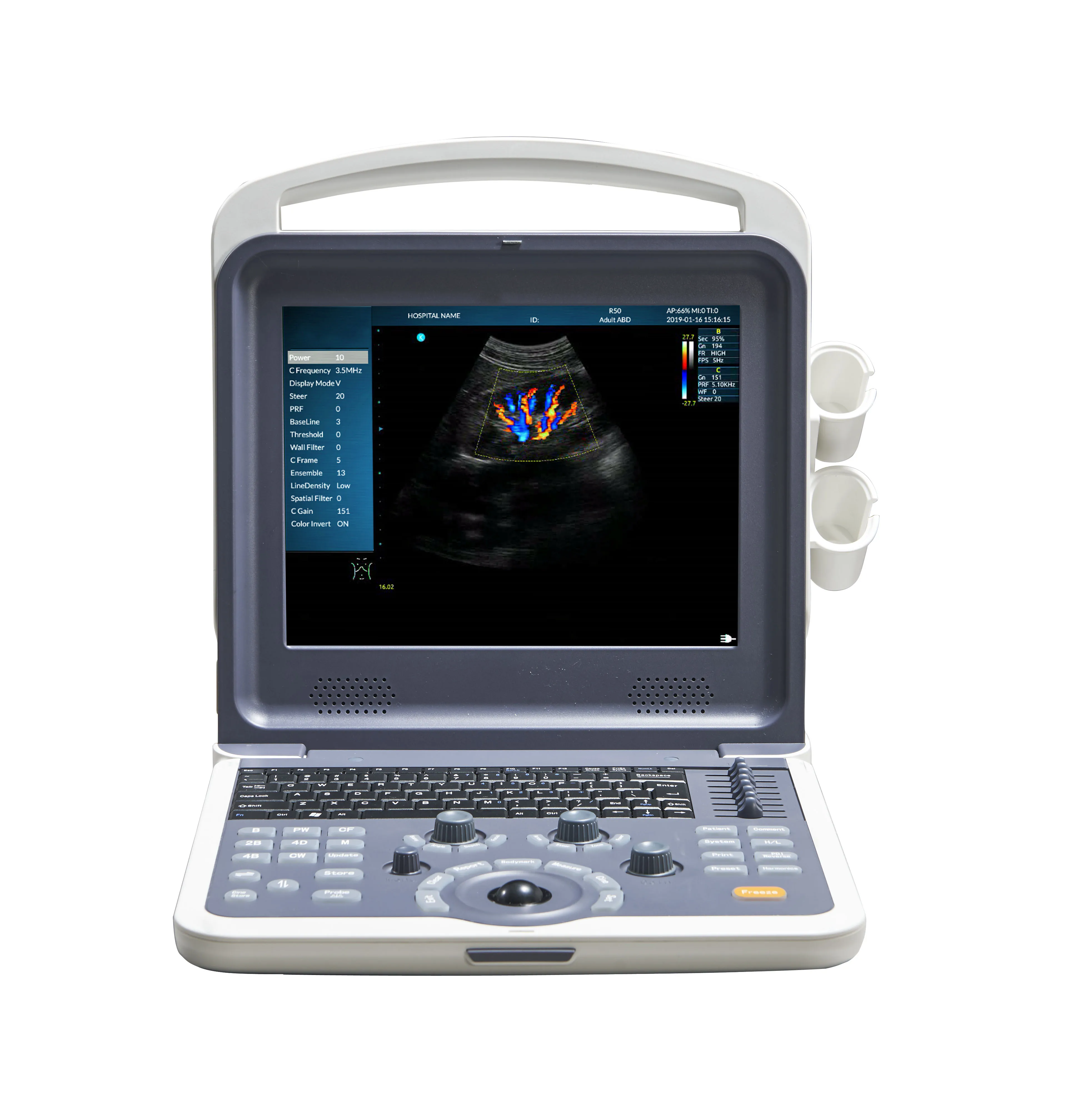 Real-Time Panoramic Image Pulsed Ultrasound Low Frequency Medical Ce Convex Ultrasound Probe Voluson E8 m Ultrasound 3D