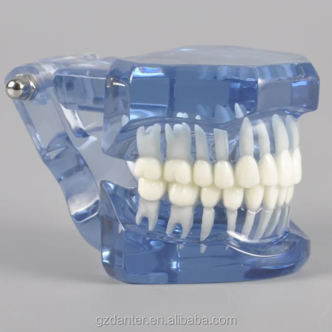 Orthodontic Dental Model Typodont with Transparent Jaw Without Braces Orthodontic Teeth Study Model No Braces Blue