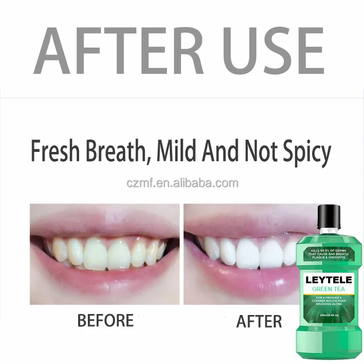 Private Label 250ML Natural Organic Teeth Whitening Oral Care Cleans Your Teeth Green Tea Mouthwash