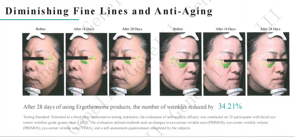 The Nextgeneration Natural Antioxidant Ingredients Lergothioneine 99.