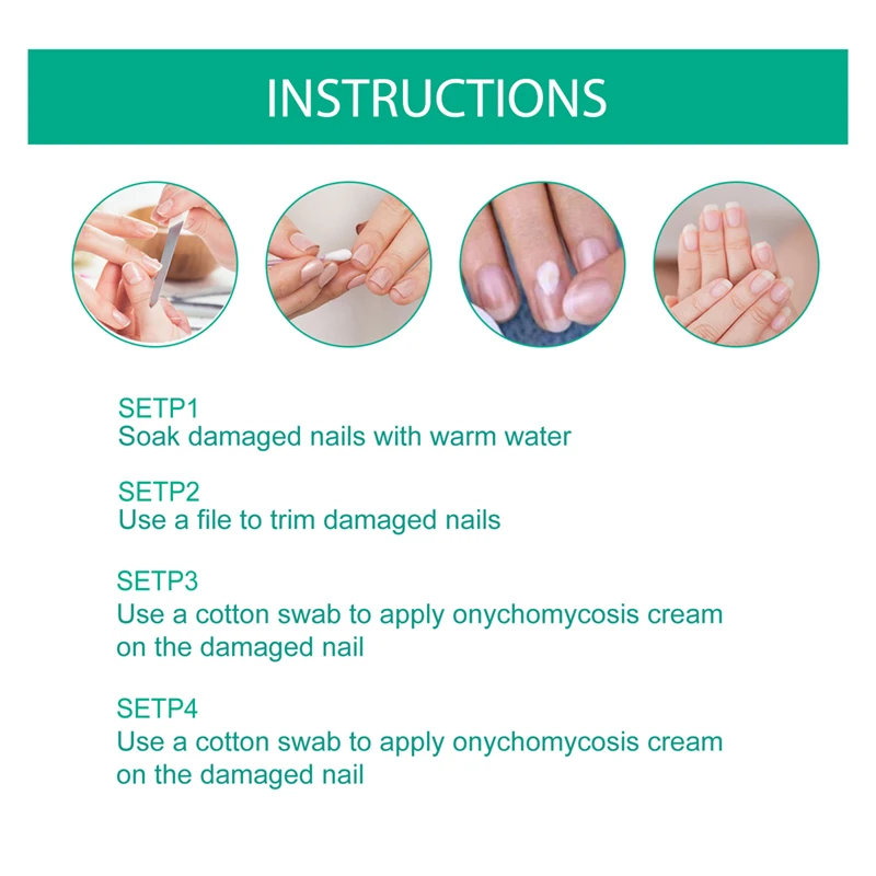 20g nail fungus ointment bacterial fungal relieving nail nourishing repair cream