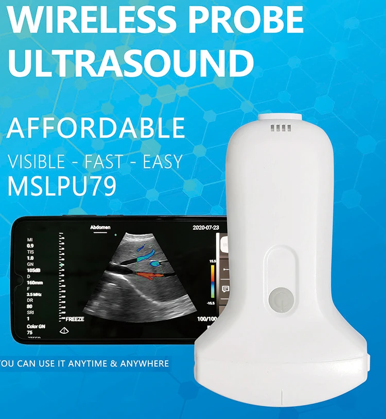 Portable Dual Scanner Wireless Ultrasound Linear Probe 128 Elements High Frequency Handheld Electric Power Made Metal Plastic