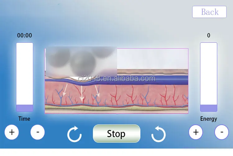 Professional ADG for Endospheres Slimming Massager Machine New Technology Inner Ball Roller for Body & Cellulite Reduction