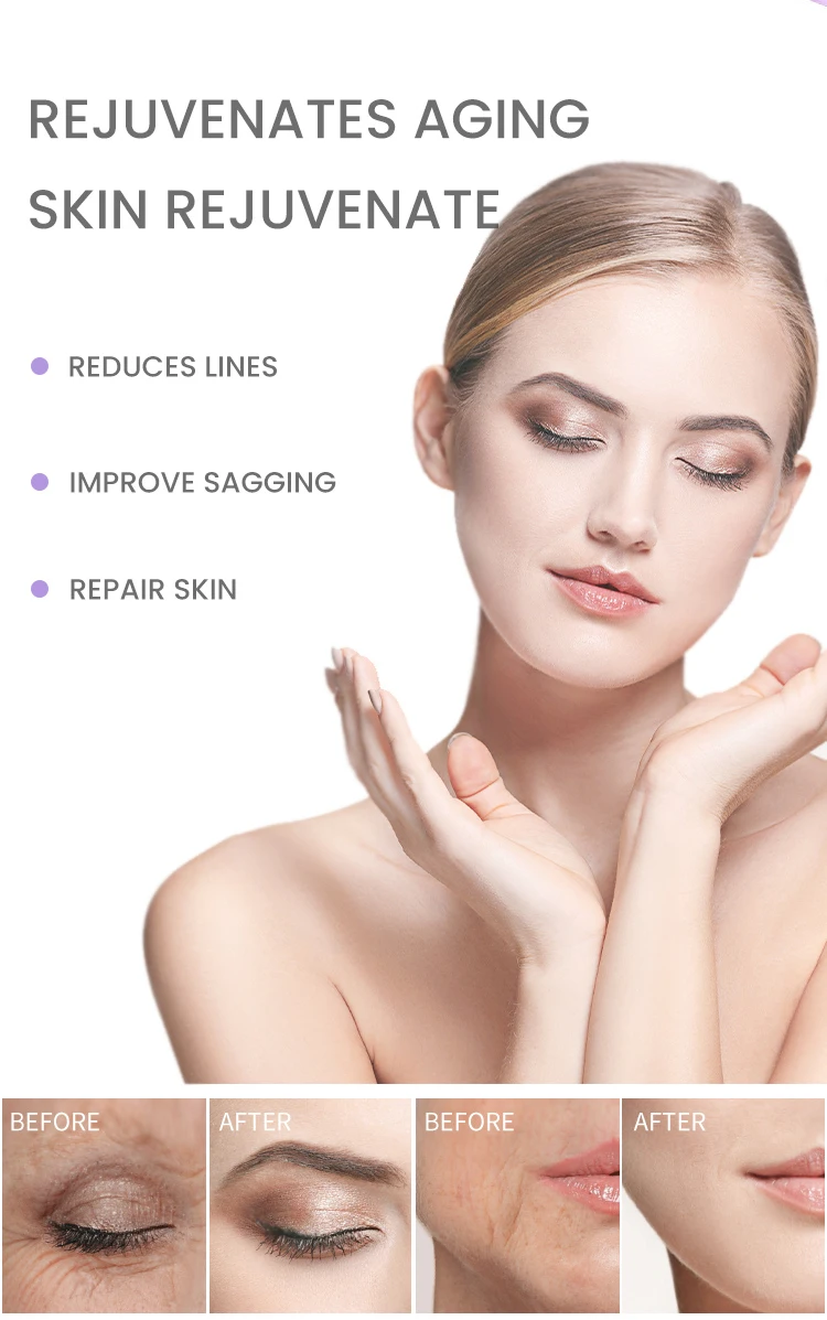 ESTELIN Skin Firming Moisturizing Anti Wrinkle Retinol Facial Serum 30ml