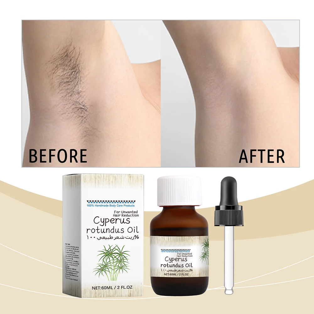 Factory Private Label Natural Gentle Painless Hair Removal Oil Cyperus Oil Hair Remover Permanent Hair Removal Oil