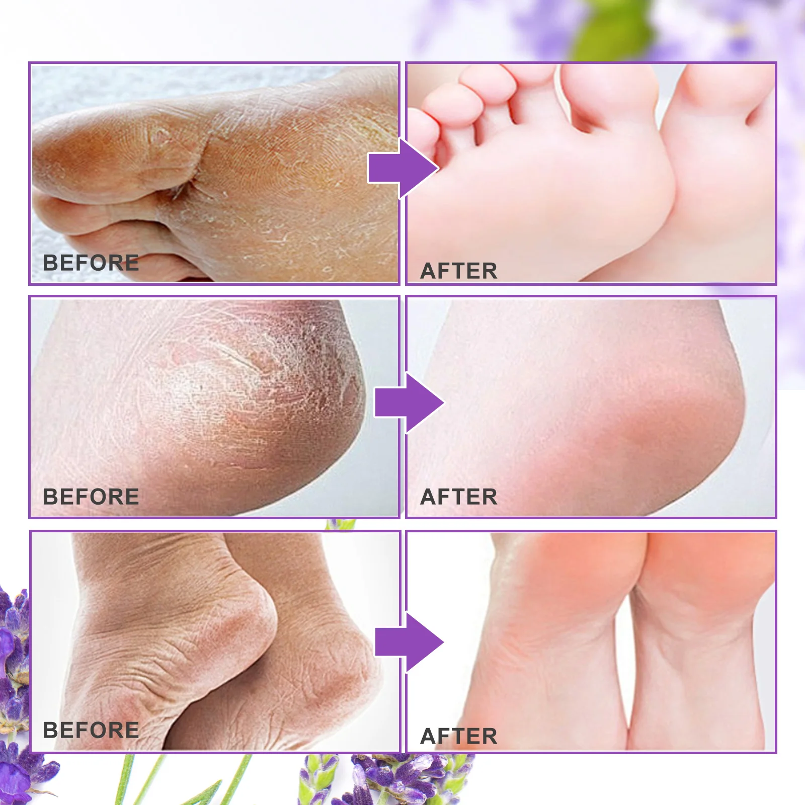 Aliver Foot Mask Exfoliate Dead Skin Calluses