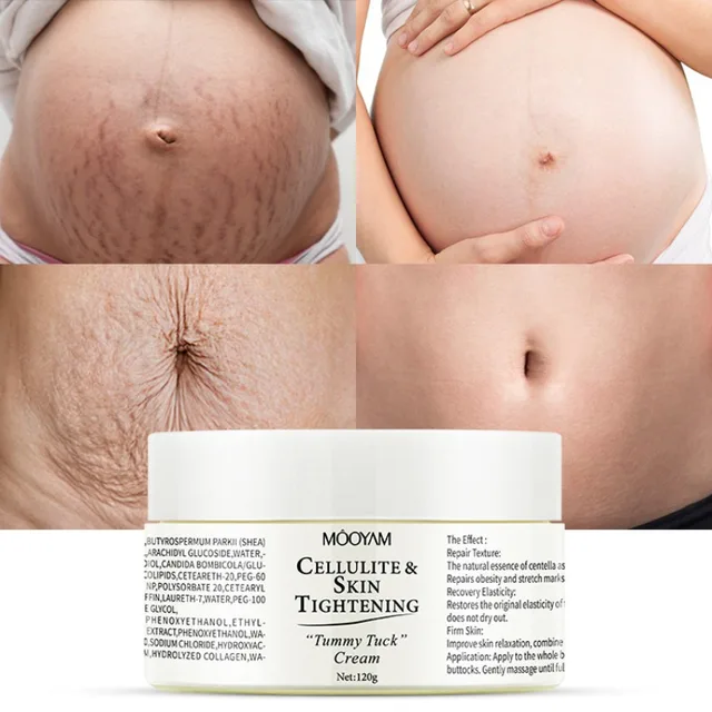 Stretch Mark Cream Body Line Care Cream Tightenning Nourishing Lightenning Postpartum Stretch Marks Repair Cream