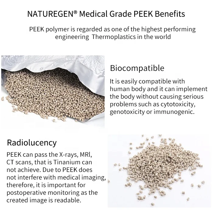 Implantable Raw Material Polyether Ether Ketone Pure Powder Peek Pellets Price of Peek Per kg