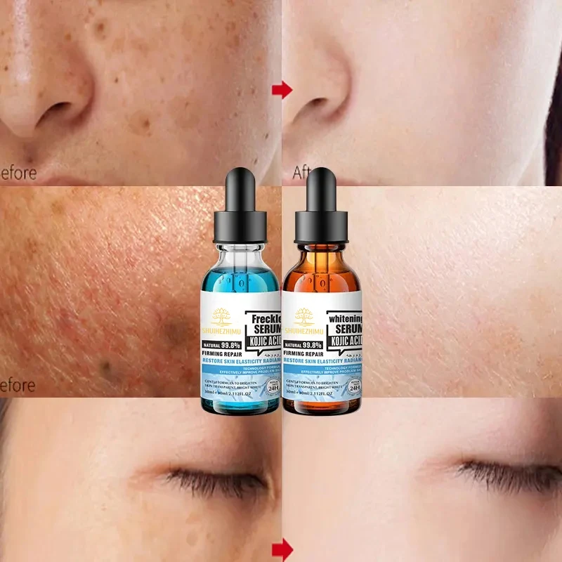 Best Skincare Set Organic Facial Hyaluronic Acid Anti Aging Acne Kojic