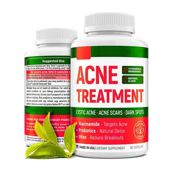 OEM Private Label Acne Pills for Teens & Adults Perfect Skin Capsules for Cleanse Acne Hormonal Acne with Vitamin