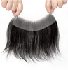 hair line