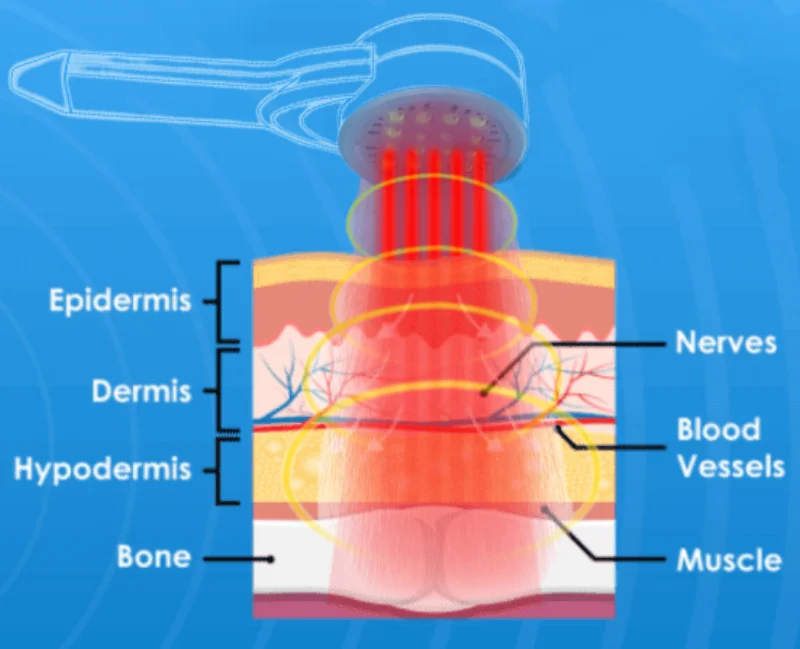Pemf Therapy Device Pemf Loop For Horses China