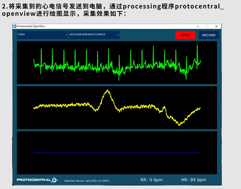 Ads1292 Ecg Sensor Respiratory Collection Ecg Heart Rate Detection ...