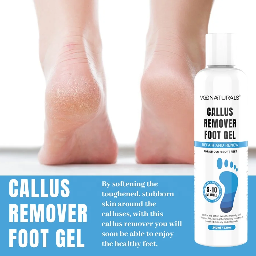 private label foot callus remover gel